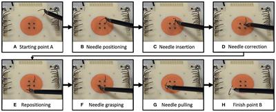 Surgeon-Centered Analysis of Robot-Assisted Needle Driving Under Different Force Feedback Conditions